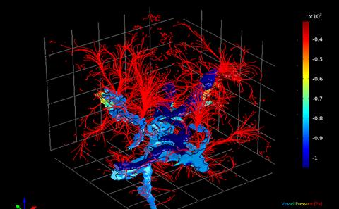 Correlative 3D Imaging and Microfluidic Modelling of Human Pulmonary Lymphatics