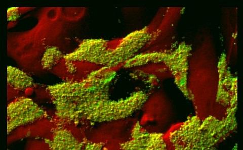 Image of gonococci (in green) and endometrial cells (in red)