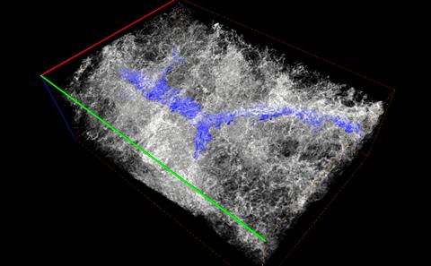 link to Mapping 3D Networks in Human Lung tissue using Micro-Computed Tomography