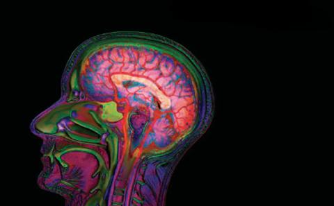 Lit up human brain
