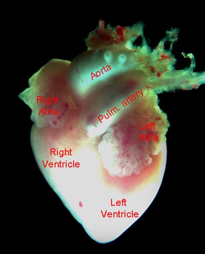 Human fetal heart ~ 10 weeks