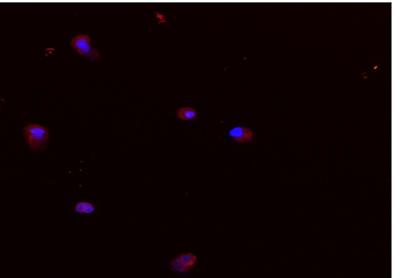 Stem cells with release of fluorescent oligonucleotides in red. 