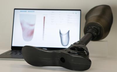 Radii Devices uses AI to improve prosthetic fit