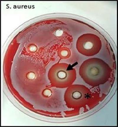 Culture plate showing inhibition of bacterial growth around clay gel
