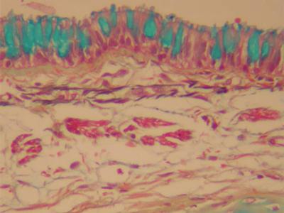 Section of lung stained by the Movat’s pentachrome technique