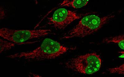 Confocal microscopy image of HeLa cells stained with the nucleolar marker, nucleophosmin (green) and the mitochondrial marker, COXIV (red).