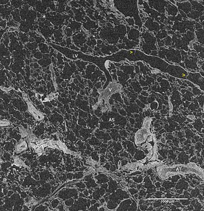 Representative orthoslice of human lung tissue scanned at 6 μm pixel resolution