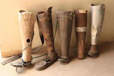 Robust prosthetics are available for harsh environments, such as agricultural work.