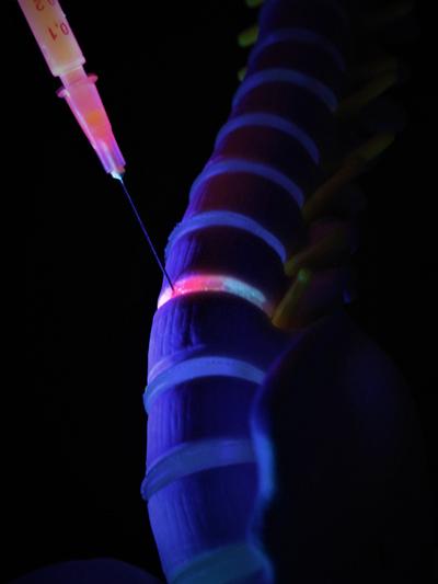 The nanoclay acts as a drug deliverer and scaffold