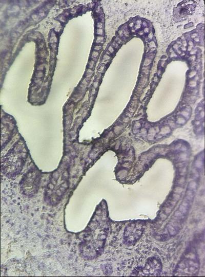 Section of gut after laser dissection. Image courtesy of Karen Pickard