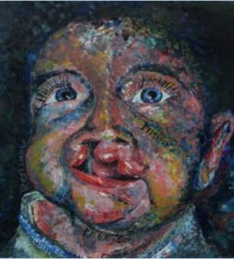 Entry by Lydon Eccles illustrates a child with an unrepaired cleft lip