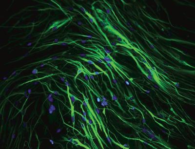 Neural stem cells differentiation into neurons (Beta-III-tubulin) green, nuclei in blue