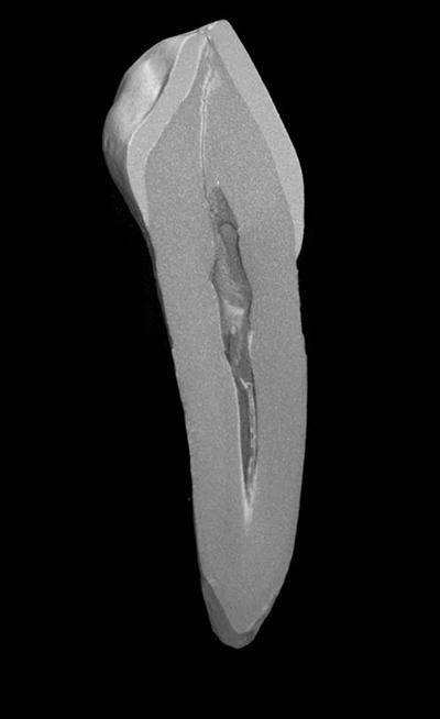Tooth cross section