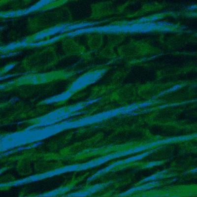 Multiphoton fluorescence & second harmonic imaging of GFP & collagen in drosophila brain tissue