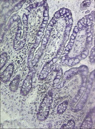Section of gut before laser dissection. Image courtesy of Karen Pickard