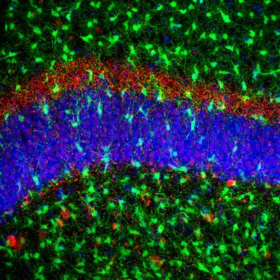 Microglial cells (green) increase in number in the brain with chronic neurodegnerative diseases.