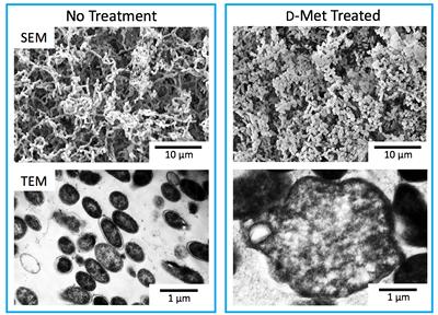 Image of biofilms before and after treatment