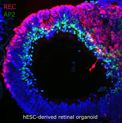 hESC derived retinal organoid