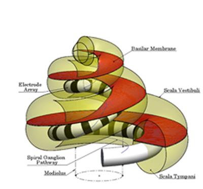 A model of the structure of the inner ear into which a cochlear implant has been inserted which is used to predict the generated voltage field