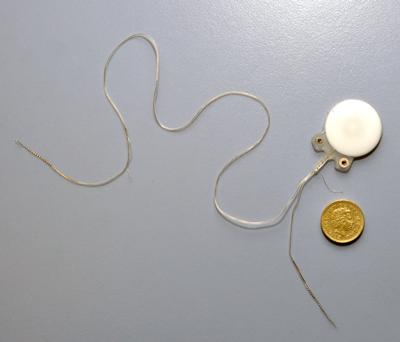 First single implant to give sound in both ears