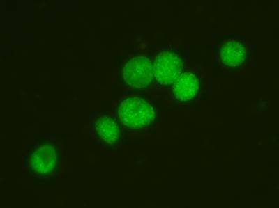 Green fluorescence of transformed chlamydia trachomatis. Wang et al 2011.