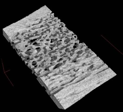 Slice of trabecular bone captured using Computer Tomography