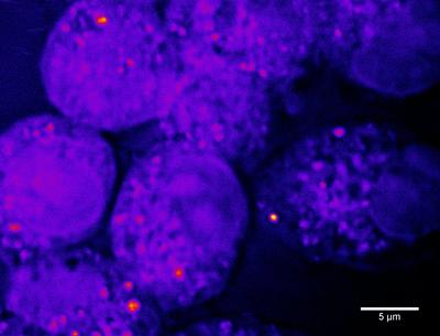 Label-free imaging of surfactant in macrophage cells