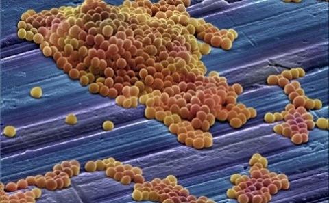 MRSA (Annie Cavanagh) Wellcome