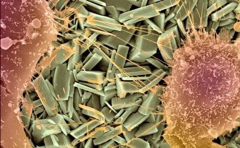 Cells on ceramic crystals