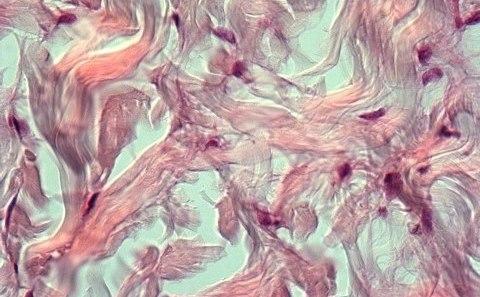 Human skin cells