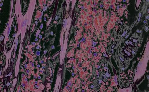 Heart muscle