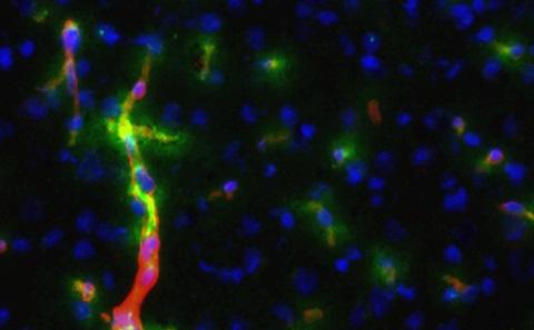 Image credit: Prof Jessica Teeling