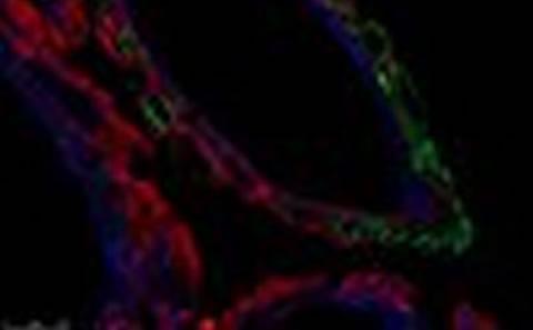 Blood-Brain Barrier Symposium