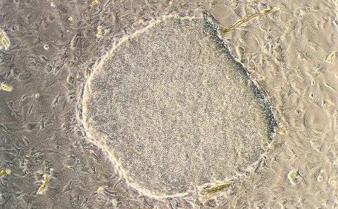 Stem Cells