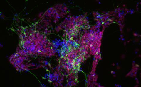 Neuronal progenitors