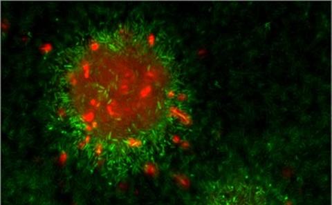 Biofilm