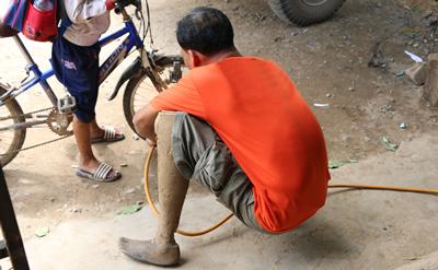 Prosthetics in Cambodia