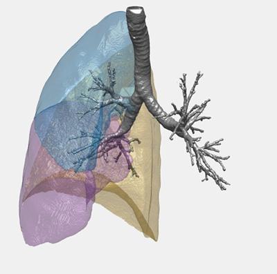 Image of a lung