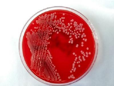Petri dish containing Acinetobacter