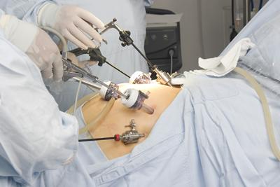 Image of operation being performed