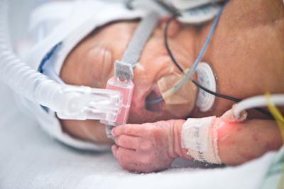 Neonatal baby