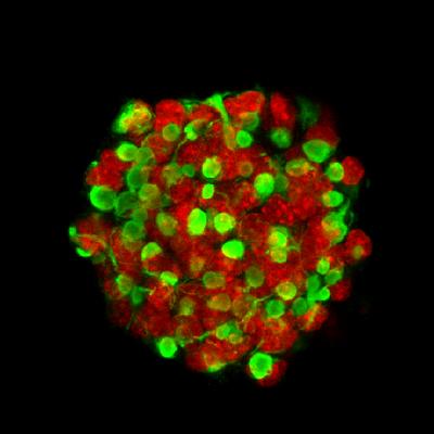 Image of neural stem cells