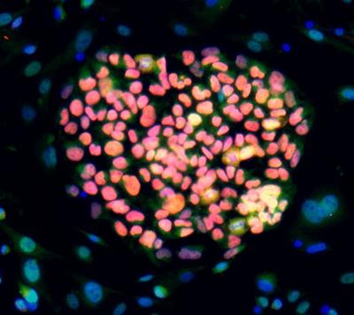 Human embryonic stem cell colony