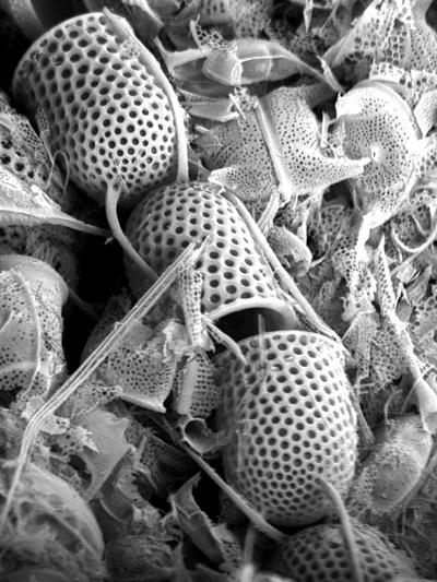 Electron micrograph (Alan Davies)