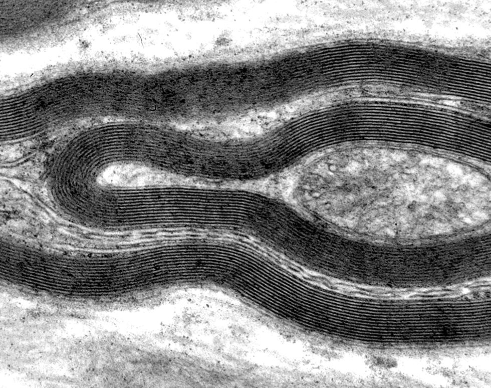 Tem Brain TEM Image Gallery | Biomedical Imaging Unit | University of Southampton