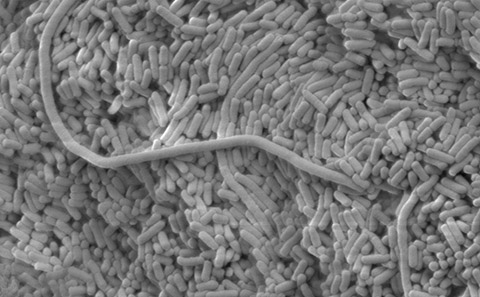 Microscope image of bacteria