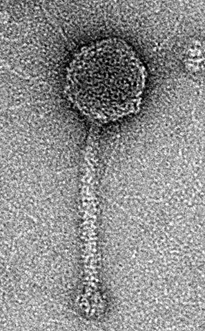 Microscope image of phage virus