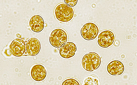 Microscope image of coral algae.