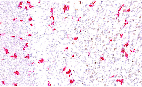 Microscopy image of human microglia