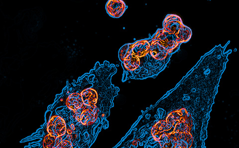 Macrophages  (blue) engulfing tumour cells (orange)